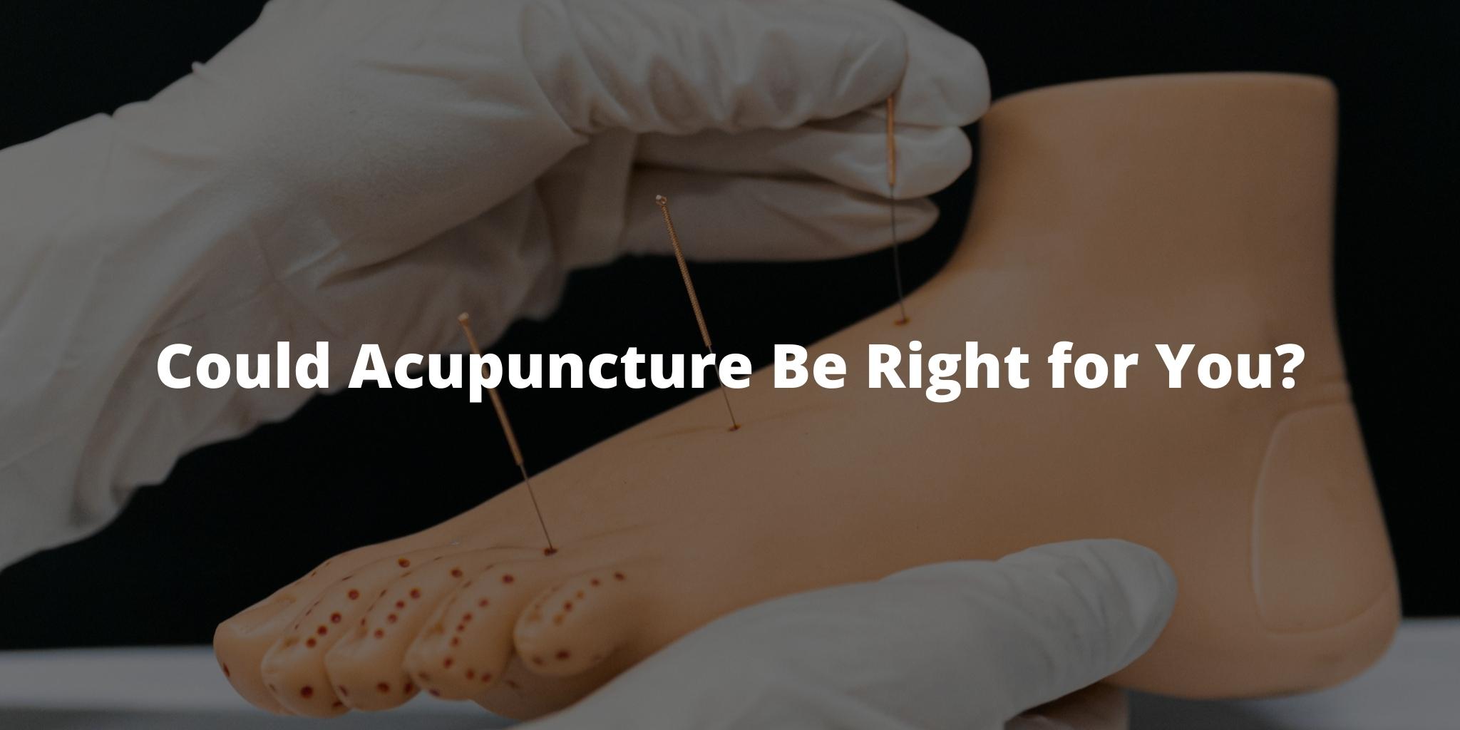Could Acupuncture Be Right for You?